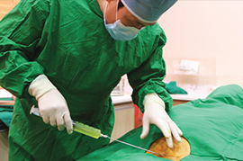 Liposuction Image